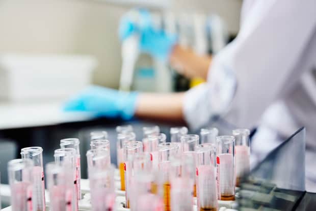 Uterine PRP or Intrauterine platelet-rich plasma in assisted reproduction treatment