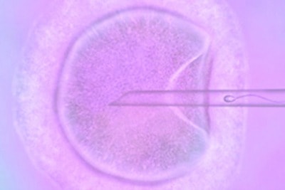 Differences between artificial insemination and in vitro fertilisation