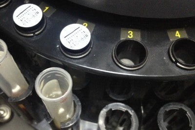 In vitro fertilisation: which hormones do we monitor during an IVF cycle?